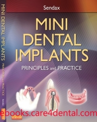 Mini Dental Implants: Principles and Practice (pdf)