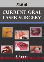 Atlas of Current Oral Laser Surgery (pdf)