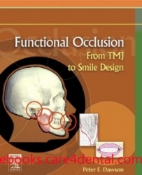 Functional Occlusion: From TMJ to Smile Design (pdf)