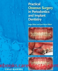 Practical Osseous Surgery in Periodontics and Implant Dentistry (pdf)