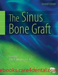 The Sinus Bone Graft (pdf)