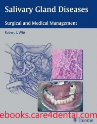 Salivary Gland Diseases: Surgical and Medical Management (pdf)