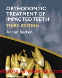 Orthodontic Treatment of Impacted Teeth, 3rd Edition (pdf)