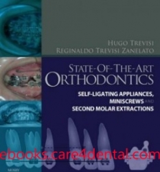 State-of-the-Art Orthodontics: Self-Ligating Appliances, Miniscrews and Second Molars Extraction (pdf)