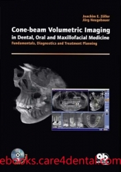 Cone-beam Volumetric Imaging in Dental, Oral and Maxillofacial Medicine: Fundamentals, Diagnostics, and Treatment Planning (pdf)