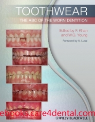 Toothwear: The ABC of the Worn Dentition (pdf)