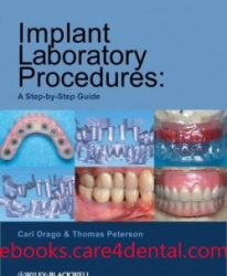 Implant Laboratory Procedures: A Step-by-Step Guide (pdf)
