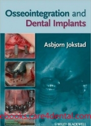 Osseointegration and Dental Implants (pdf)