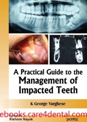 A Practical Guide to the Management of Impacted Teeth (pdf)