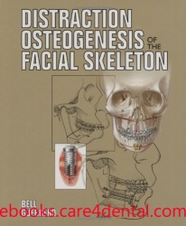 Distraction Osteogenesis of the Facial Skeleton (pdf)