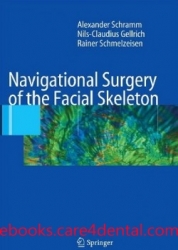 Navigational Surgery of the Facial Skeleton (pdf)