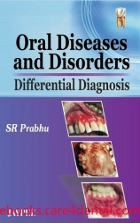 Oral Diseases and Disorders: Differential Diagnosis (pdf)