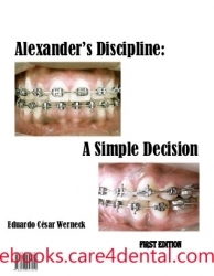 Alexanders Discipline: A Simple Decision (pdf)