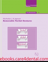 Removable Partial Dentures (PDF+EPUB)