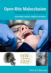 Open-Bite Malocclusion: Treatment and Stability (pdf)