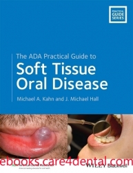 The ADA Practical Guide to Soft Tissue Oral Disease (pdf)