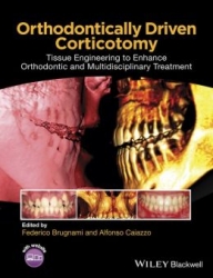 Orthodontically Driven Corticotomy: Tissue Engineering to Enhance Orthodontic and Multidisciplinary Treatment (pdf)