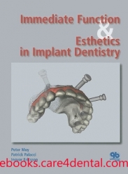Immediate Function and Esthetics in Implant Dentistry (pdf)