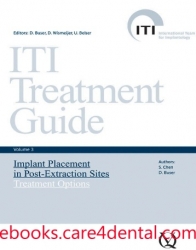 ITI Treatment Guide, Vol 3: Implant Placement in Post-Extraction Sites – Treatment Options (.epub)